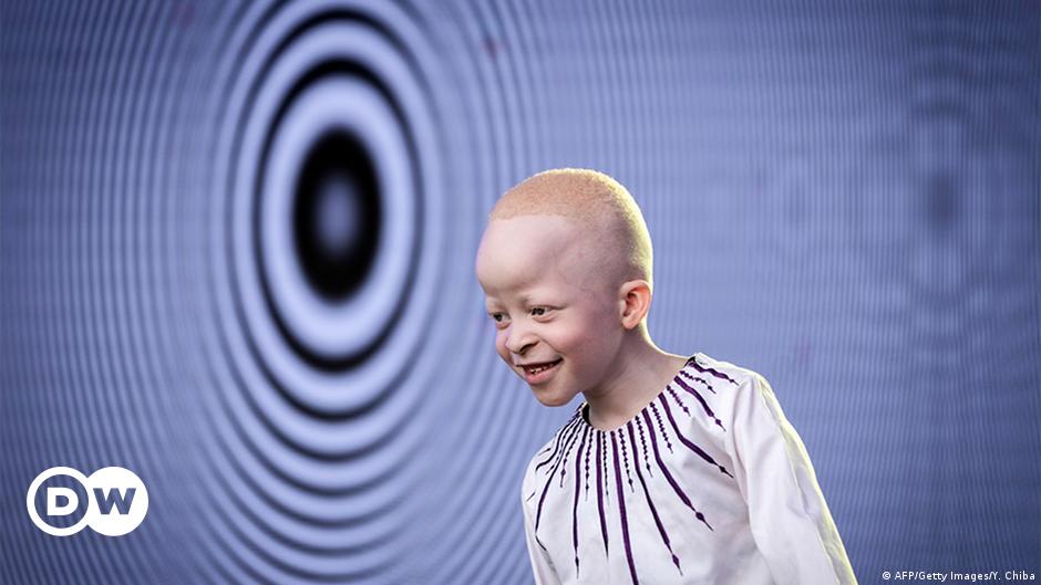 Albinismus in der Corona-Pandemie