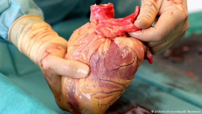 Organtransplantation Herz
