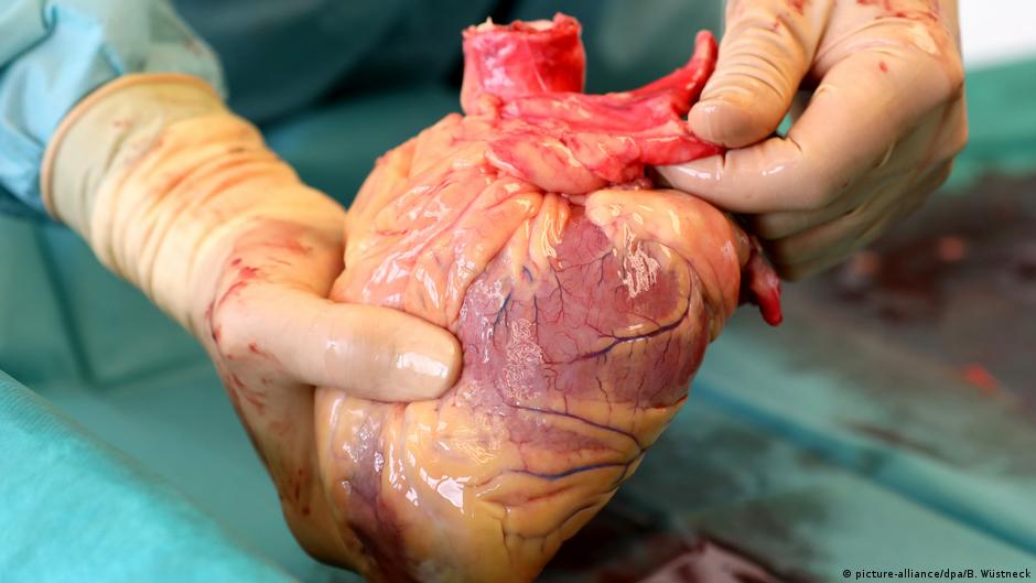 Organ donations: How to make up the shortfall | Science| In-depth reporting on science and technology | DW - Vimarsana News