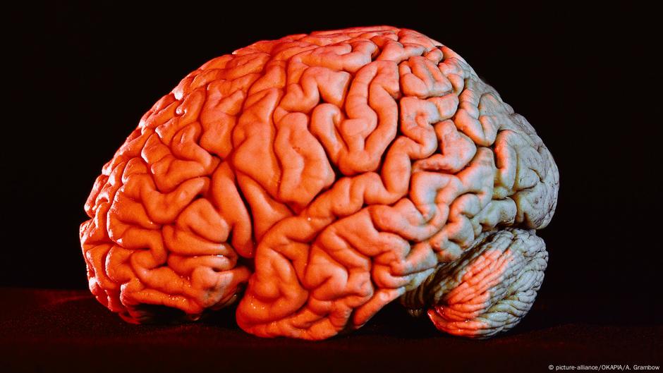 Covid 19 Severe Brain Damage Possible Even With Mild Symptoms Science In Depth Reporting On Science And Technology Dw 09 07 2020