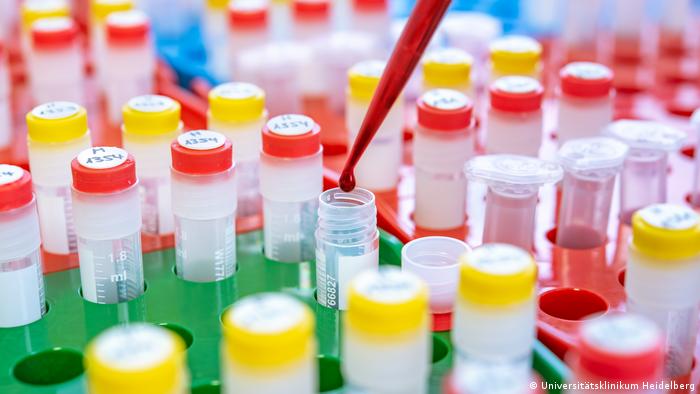 Universitätsklinikum Heidelberg Bluttests bei Brustkrebs Universitätsklinikum Heidelberg Bluttests bei Brustkrebs