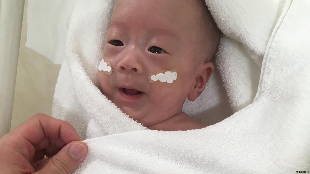 World's smallest baby born in Japan – DW – 02/28/2019