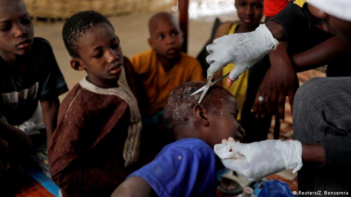 Ein Arzt behandelt ein Kind, das sich mit Krätze angesteckt hat (Reuters/Z. Bensemra)