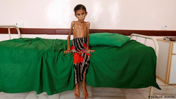 Jemen Krieg Hungersnot (Reuters/K. Abdullah)