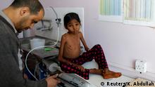 A nurse weighs Afaf Hussein, 10, who is malnourished, at the malnutrition treatment ward of al-Sabeen hospital in Sanaa, Yemen, January 31, 2019. Afaf, who now weighs around 11 kg and is described by her doctor as skin and bones, has been left acutely malnourished by a limited diet during her growing years and suffering from hepatitis, likely caused by infected water. She left school two years ago because she got too weak. REUTERS/Khaled Abdullah SEARCH YEMEN HUNGER FOR THIS STORY. SEARCH WIDER IMAGE FOR ALL STORIES. TPX IMAGES OF THE DAY