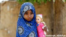 Afaf Hussein, 10, who is malnourished, holds her doll near her family's house in the village of al-Jaraib, in the northwestern province of Hajjah, Yemen, February 20, 2019. Afaf, who now weighs around 11 kg and is described by her doctor as skin and bones, has been left acutely malnourished by a limited diet during her growing years and suffering from hepatitis, likely caused by infected water. She left school two years ago because she got too weak. REUTERS/Khaled Abdullah SEARCH YEMEN HUNGER FOR THIS STORY. SEARCH WIDER IMAGE FOR ALL STORIES.