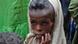 Anak yang kekurangan gizi di Ethiopia. Anak yang kekurangan gizi di Ethiopia.