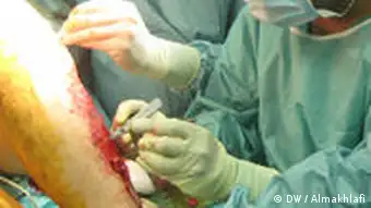 Trasplante de piel en un paciente quemado.