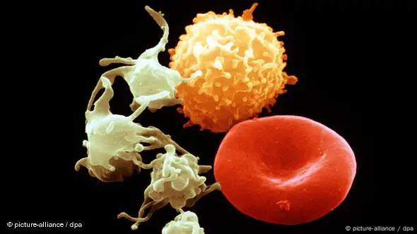 Mikroskopaufnahmen der Blutzellen des Menschen:Erythrozyten(rot), Leukozyten(gelb) und Thrombozyten(weiß) (Foto: dpa)