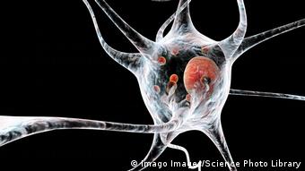 Εκφυλισμός κυττάρων στη νόσο του Πάρκινσον