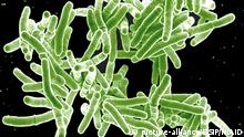 Scanning electron micrograph of Mycobacterium tuberculosis bacteria, which cause TB. | Verwendung weltweit, Keine Weitergabe an Wiederverkäufer.