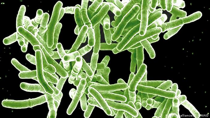 Microscopic picture of Mycobacterium tuberculosis