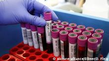 Covid-19: Sangue de curados trata pacientes na região com mais infeções da Itália