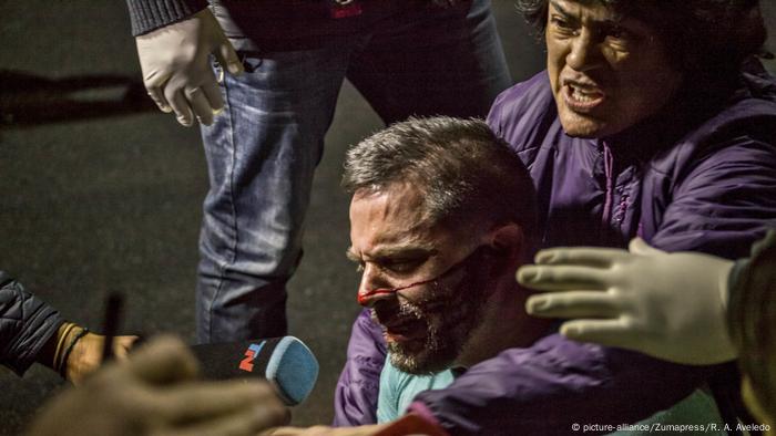 Venezuela politische Krise Ausschreitungen in Caracas (picture-alliance/Zumapress/R. A. Aveledo)