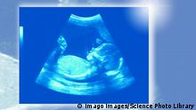 20-week baby scan 20-week baby ultrasound scan. PUBLICATIONxINxGERxSUIxHUNxONLY IANxHOOTON/SCIENCExPHOTOxLIBRARY F005/6185
20 Week Baby Scan 20 Week Baby ultrasound Scan PUBLICATIONxINxGERxSUIxHUNxONLY IANxHOOTON SCIENCExPHOTOxLIBRARY F005
