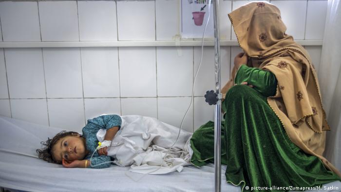 Unterernährtes Kind in einem Krankenhaus in Kabul, Afghanistan