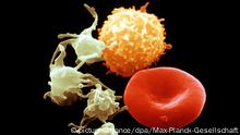 Die Blutzellen des Menschen: Erythrozyten (rot), Leukozyten (gelb) und Thrombozyten (grün). Reife rote Blutkörperchen (Erythrozyten) haben die Gestalt bikonkaver Scheiben. Weil ihnen der Zellkern fehlt, könne sie sich verformen und auch Blutkapillaren passieren, deren Durchmesser nur halb so groß ist wie ihr eigener. So dringen sie in die entlegendsten Winkel des Körpers vor und versorgen ihn mit Nährstoffen und Sauerstoff. Die weißen Blutkörperchen (Leukozyten) sind ebenfalls relativ klein und dank ihrer vielen Fortsätze an der Zelloberfläche gut beweglich. Sie spielen eine zentrale Rolle in der Immunabwehr. Blutplättchen (Thrombozyten) entstehen als Abschnürungen von Vorläuferzellen im Knochenmark. Sie sind besonders wichtig bei der Bildung eines Wundverschlusses nach Verletzungen. Im Blut haben sie normalerweise die Form bikonvexer Scheiben, stülpen aber nach Aktivierung, wie in dieser Aufnahme, lange Fortsätze aus. Aufnahme von 2001. Am Computer nachkolorierte rasterelektronenmikroskopische Aufnahme. | Verwendung weltweit