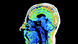 An fMRI scan of the author Marco Magrini's brain An fMRI scan of the author Marco Magrini's brain