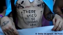 A member of the Lesbian, Gay, Bisexual, Transgender, Intersex and Queer (LGBTIQ) community bearing a message reading on his chest There used to be boobs here takes part in the annual Pride parade in Madrid, on July 6, 2019. (Photo by OSCAR DEL POZO / AFP) (Photo credit should read OSCAR DEL POZO/AFP/Getty Images)