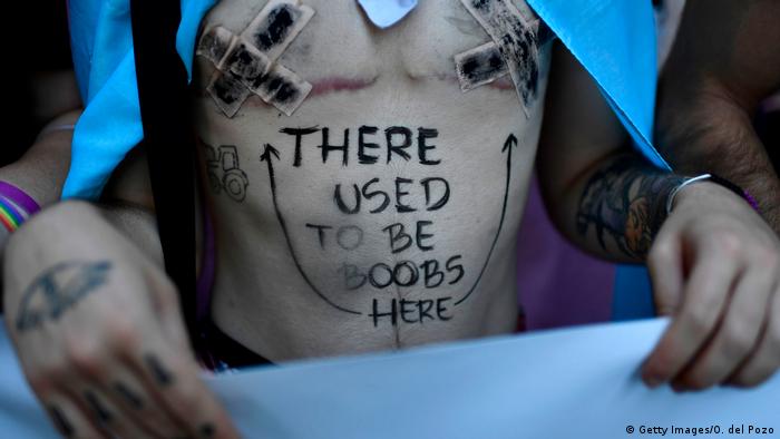 A member of the LGBT community bearing a message reading on his chest There used to be boobs here (Getty Images/O. del Pozo)