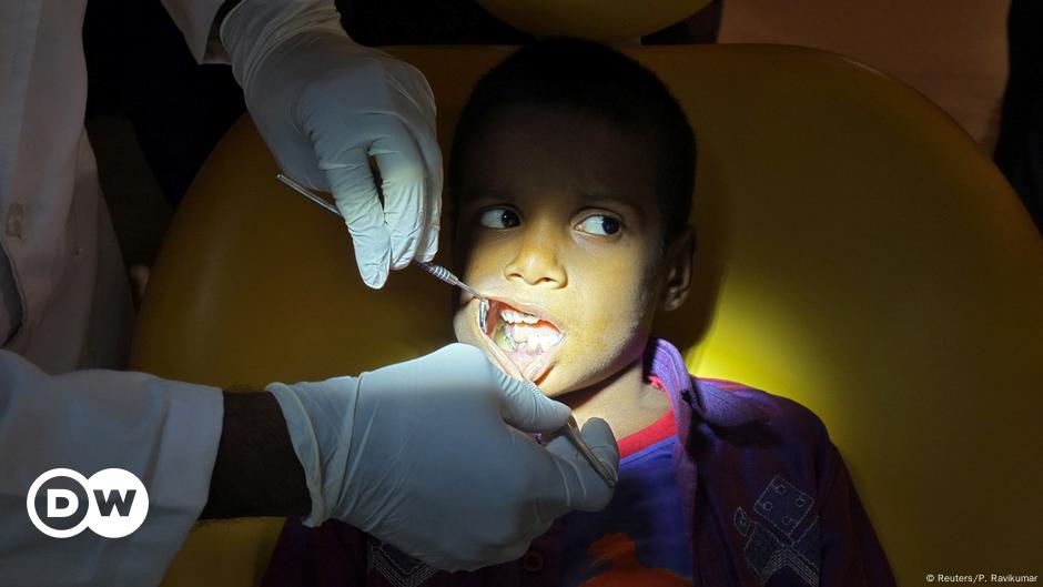 Indian Boy Has 526 Teeth Removed News Dw 02 08 2019