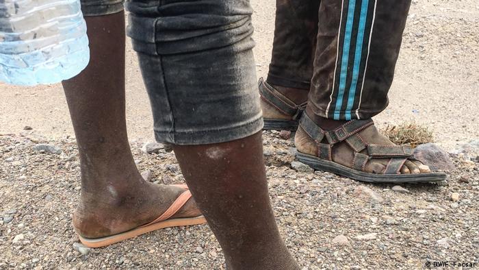 Focis on the legs and sandals of African migrants