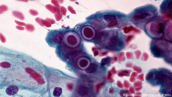 Krankheitserreger unter dem Mikroskop | Chlamydien