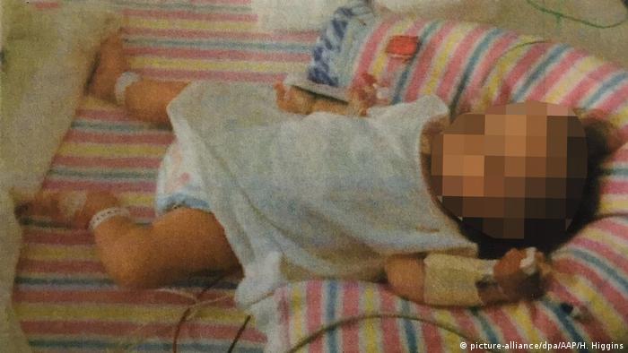عکس کودک زوج استرالیایی که به عنوان مدرکی در مورد عدم تناسب رشد و سن کودک به دادگاه ارائه شده بود