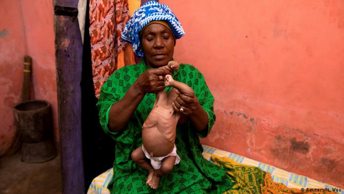 Лечителката Муания Мзи разтрива тримесечното бебе, за да прогони от него злите духове – така наречените джинове. Лекарите установили, че детето страда от нелечимо мозъчно заболяване, но майката се доверява повече на традиционната занзибарска медицина. Мзи е една от близо 340 официално регистрирани целители на остров Занзибар, който е част от Танзания.