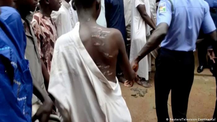 A boy is pictured with marks on his back after being rescued from a building in the northern city of Kaduna, Nigeria