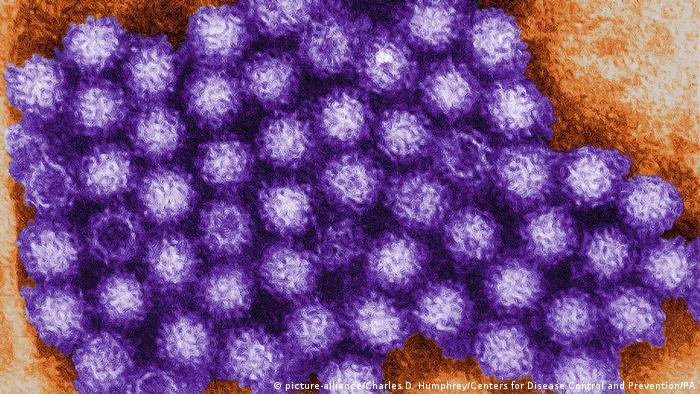  Вирусът Норовирус или Норфолк от групата на норовирусите доста постоянно е провинен за разпространяването на стомашното разстройство с гадене, повръщане и диария. Вирусът може да живее до 12 дни по зеленчуците и месните артикули. Борбата с него се води още веднъж посредством термичната обработка и дезинфекцията на ръцете. 