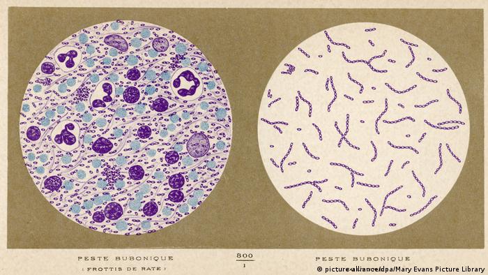 Bubonic Plague Bacillus (picture-alliance/dpa/Mary Evans Picture Library)
