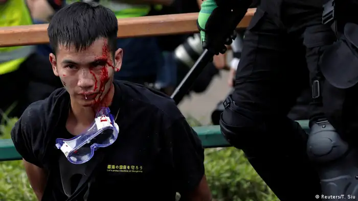 Honkong Proteste Polytechnische Universität | Verletzter