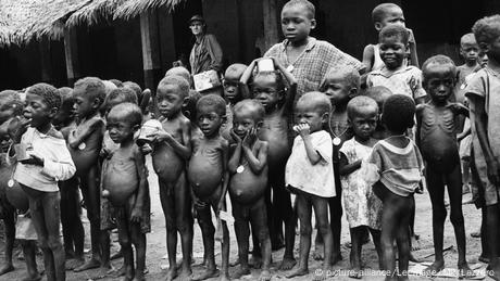 Bildergalerie Biafra-Krieg | hungernde Kinder (picture-alliance/Leemage/MP/Lazzero)