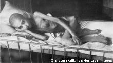 A girl victim of dystrophy, c1944-c1945. An example of the terrible hardships suffered by the civilian population of the Soviet Union during the Second World War. Over a million civilians died during the Siege of Leningrad, which lasted from 8 September 1941 until 27 January 1944. Found in the collection of the Museum of the Siege of Leningrad, St. Petersburg. (Fine Art Images / Heritage Images) | Verwendung weltweit, Keine Weitergabe an Wiederverkäufer.