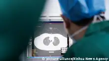 02.02.2020, China, Zhangzhou: Ein Arzt überprüft das CT-Bild der Lunge eines Patienten im Zhangzhou Municipal Hospital, in der Südostchinesische Provinz Fujian. Der Ausbruch der neuartigen Lungenkrankheit hat in China schon mehr Menschenleben gefordert als die Sars-Pandemie vor 17 Jahren. Foto: -/XinHua/dpa +++ dpa-Bildfunk +++ |