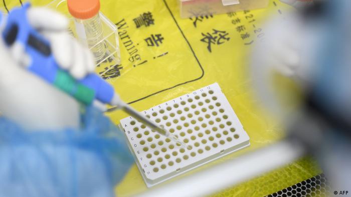 China Wuhan Labor testet auf Coronavirus
