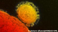 Coronavirus SARS-CoV-2 im Elektronenmikroskop
