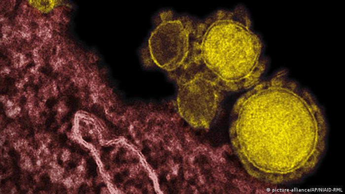 Electron microscope image of MERS virus particles 