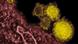 Coronavirus SARS-CoV-2 im Elektronenmikroskop Coronavirus SARS-CoV-2 im Elektronenmikroskop