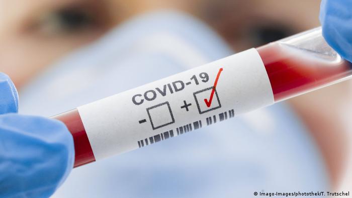 Deutschland Erste Todesfälle nach Infektionen mit Coronavirus | Symbolbild Test (Imago-Images/photothek/T. Trutschel)