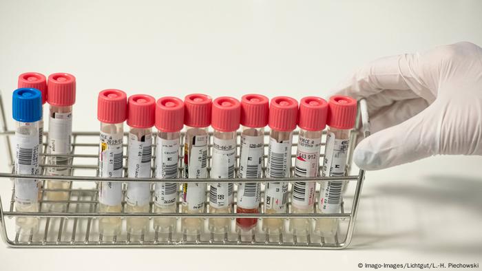 Deutschland Erste Todesfälle nach Infektionen mit Coronavirus | test