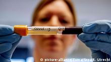 March 20, 2020, Breda, Netherlands: A lab technician holding a test tube that contains blood sample from a patient that has tested positive with the COVID-19 coronavirus at Amphia Hospital..The Amphia Hospital is currently carrying out between 400-500 tests a day for suspected cases of the COVID-19 Coronavirus. Coronavirus testing are to patients free of charge in the Netherlands. (Credit Image: © Robin Utrecht/SOPA Images via ZUMA Wire |