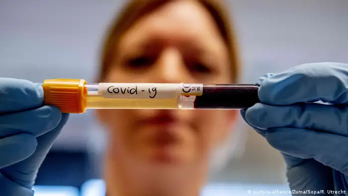 Coronavirus in Niederlande Breda Teströhrchen