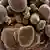 Coronaviruses on human cells under the electron microscope