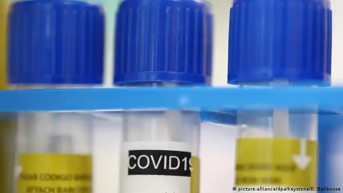 Schweiz | Coronavirus: Medizinische Röhrchen mit Tests mit der Aufschrift «Covid19»