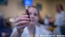 Тромбоз від вакцини AstraZeneca: німецькі вчені озвучили версію появи