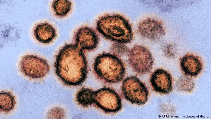 Electron microscope image of Sars-CoV-2 virus