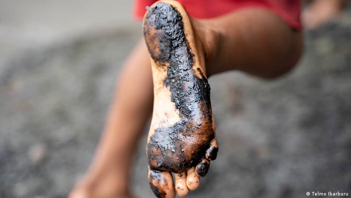  Auswirkung der Ölpest im ecuadorianischen Amazonasgebiet