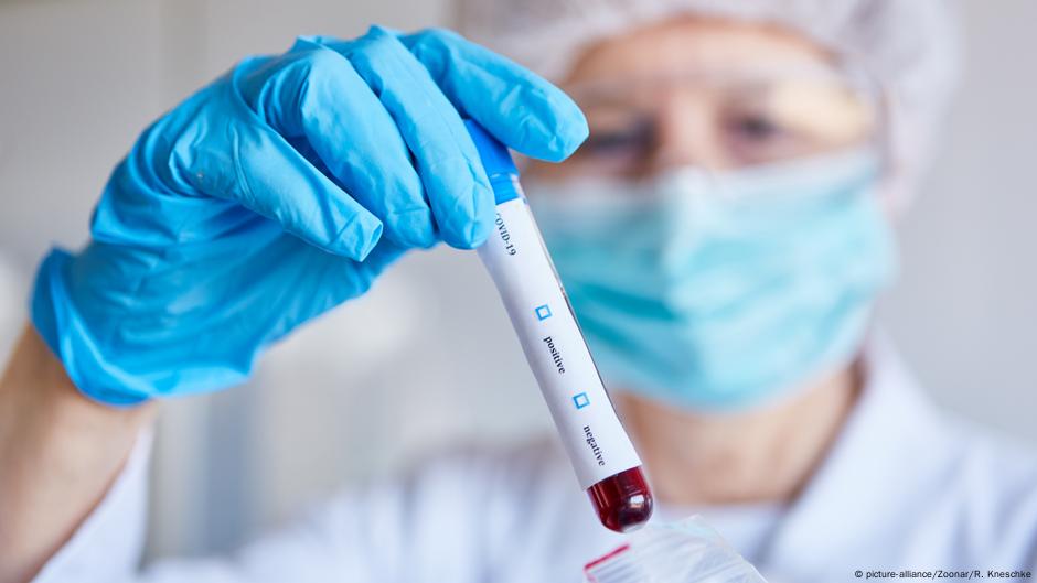 Antibodies Immunity Low After Covid 19 Recovery Science In Depth Reporting On Science And Technology Dw 14 07 2020